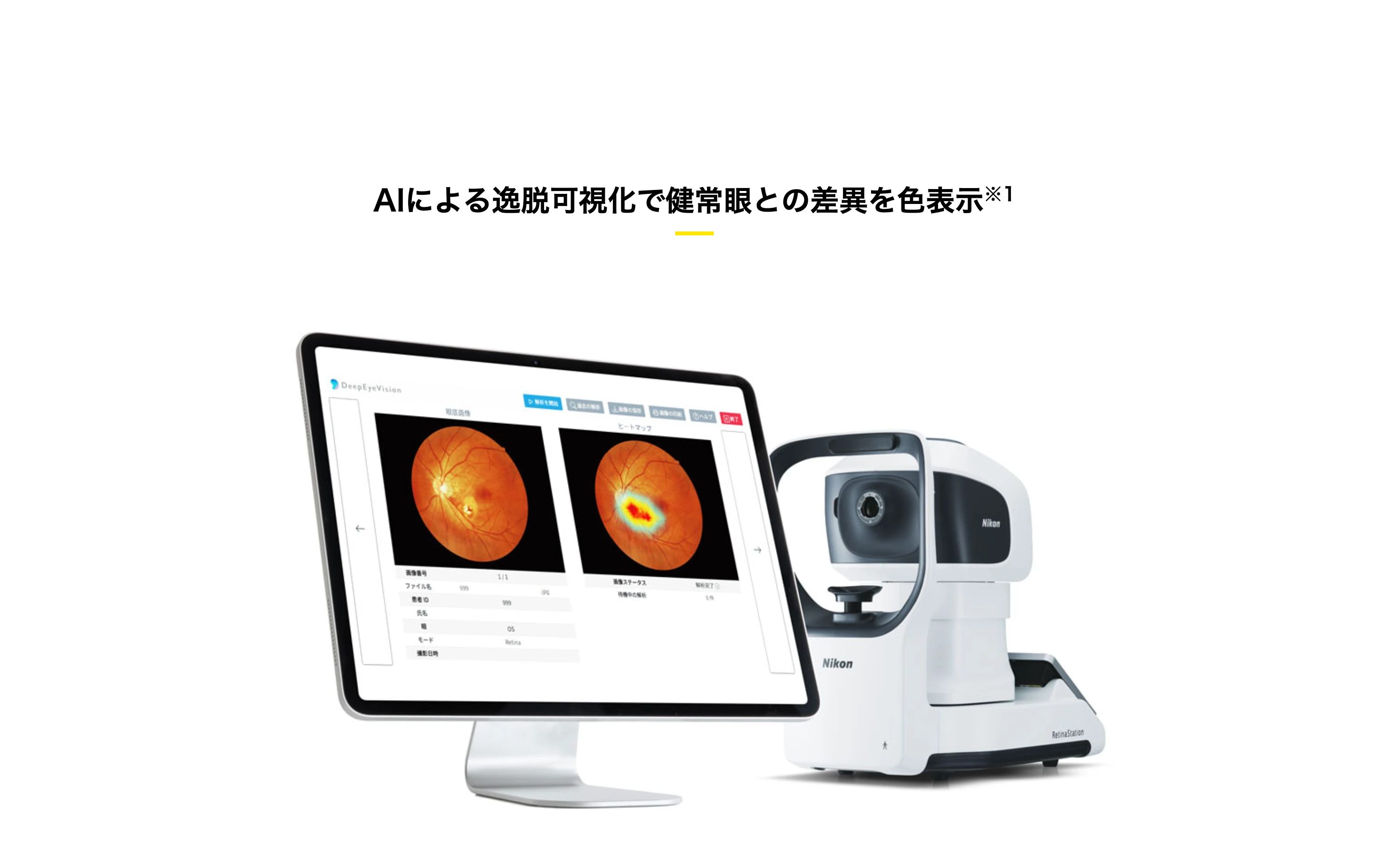 RetinaStation 用 DeepEyeVision の製品紹介。左に解析画面 (眼底画像とヒートマップを並べた DeepEyeVision の UI)、右にニコンの無散瞳眼底カメラ RetinaStation 本体が並ぶ