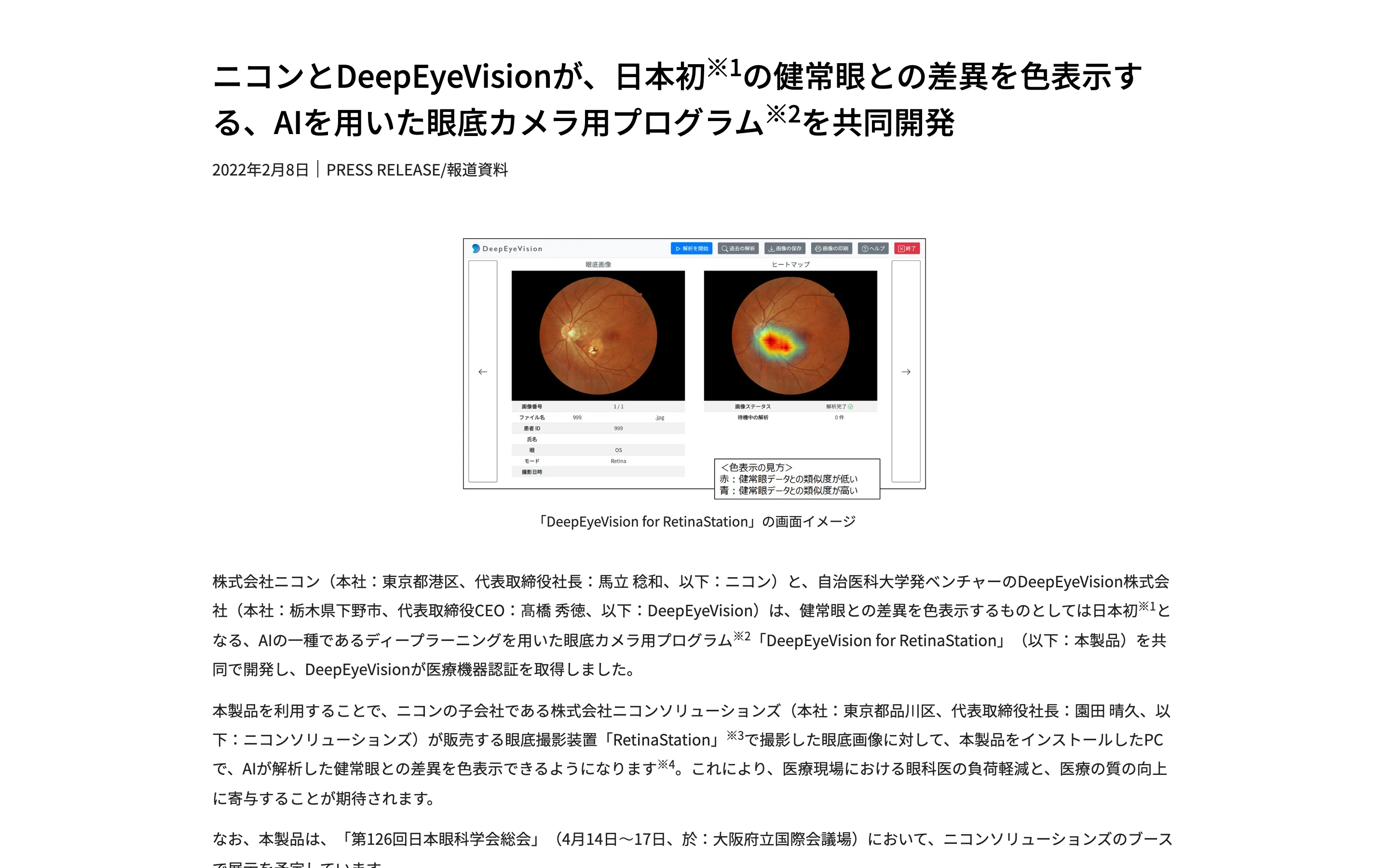 ニコンとDeepEyeVisionの共同発表ニュースリリース。見出しと、DeepEyeVision for RetinaStation の画面イメージ (左に眼底画像、右に色分けしたヒートマップ、色表示の見方の注記付き)