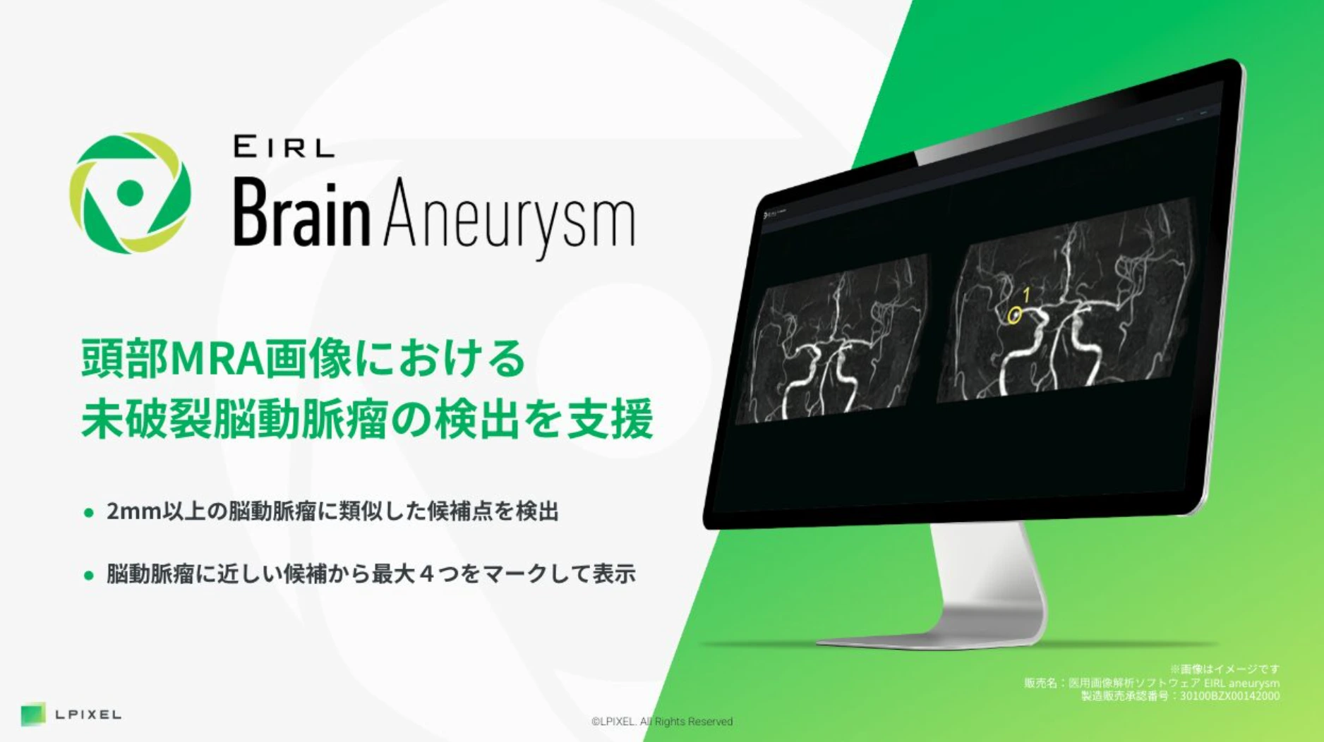 EIRL Brain Aneurysm の製品イメージ。「頭部MRA画像における未破裂脳動脈瘤の検出を支援」の文言と、MRA画像に黄色い丸で候補点が示された画面