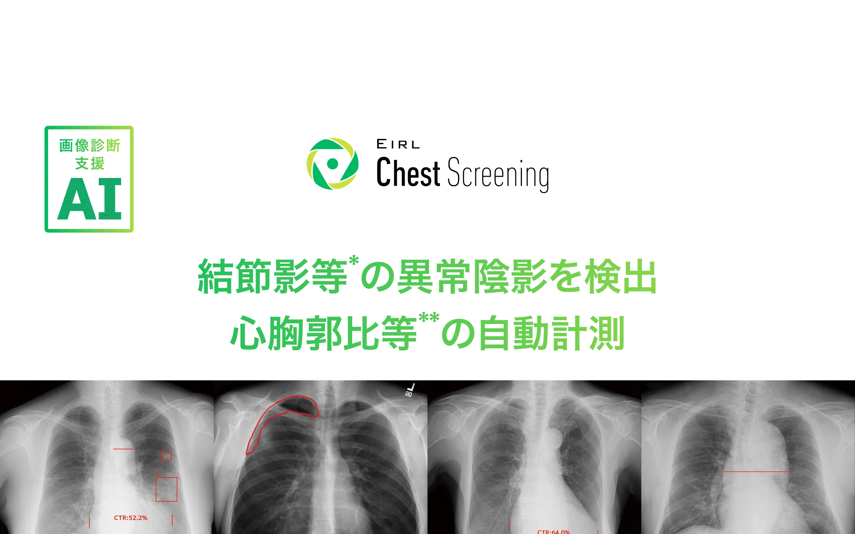 EIRL Chest Screening 公式サイトのヒーロー。「結節影等の異常陰影を検出 心胸郭比等の自動計測」と胸部X線画像4枚を掲げる