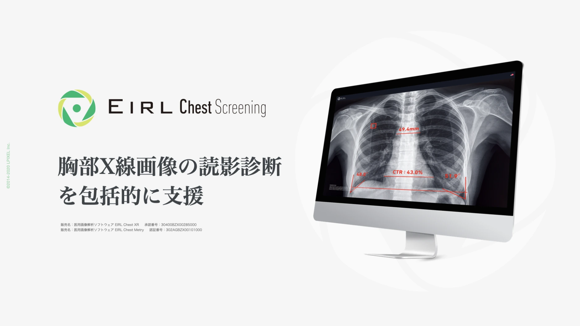 EIRL Chest Screening の製品イメージ。「胸部X線画像の読影診断を包括的に支援」の文言と、モニターに映した胸部X線画像に結節候補の赤い矩形と心胸郭比・角度の計測線が重なる画面