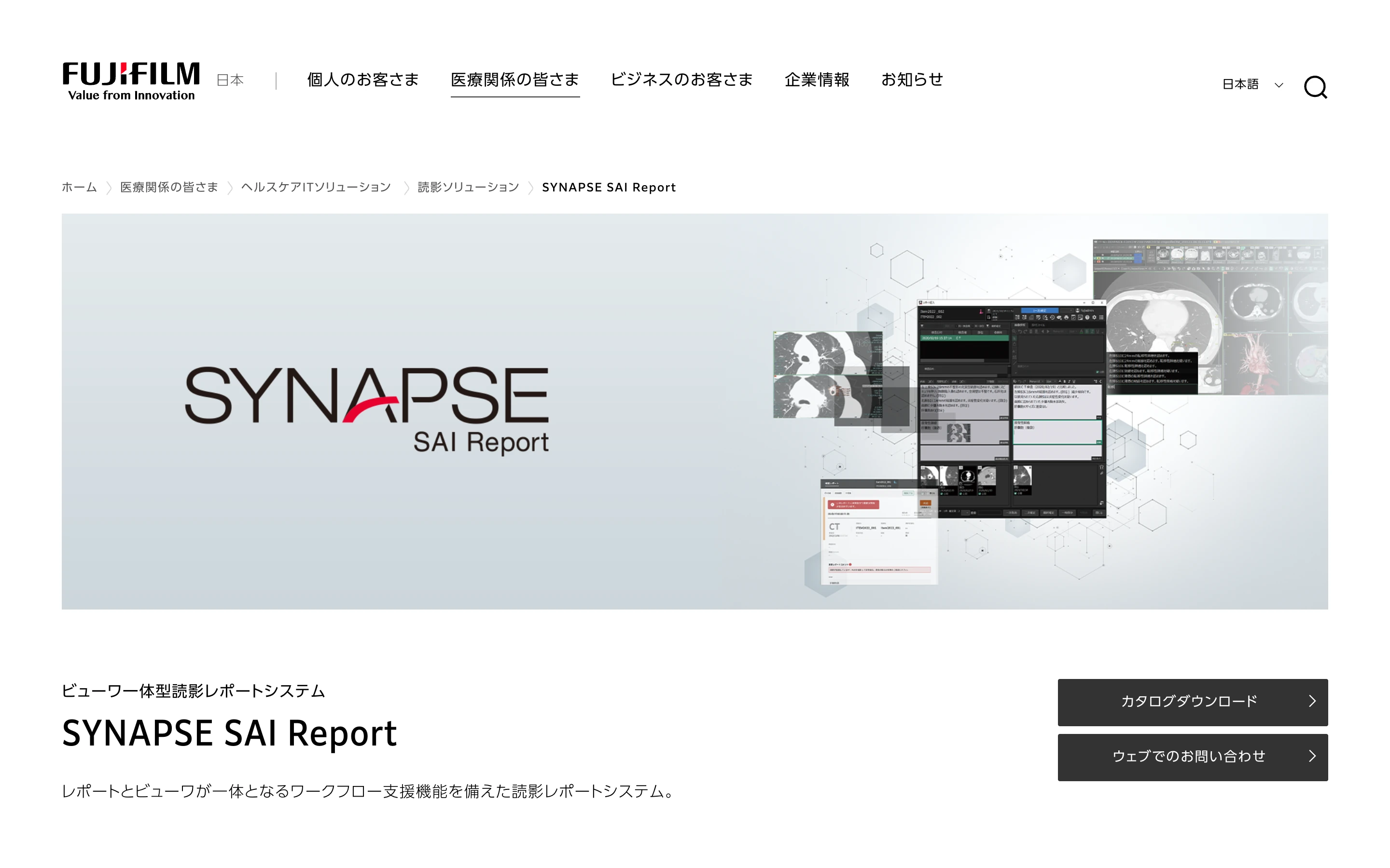 SYNAPSE SAI Report 公式サイトのヒーローセクション。読影ビューワと読影レポートを一体化した製品 UI のイメージと『ビューワー体型読影レポートシステム』のタグライン